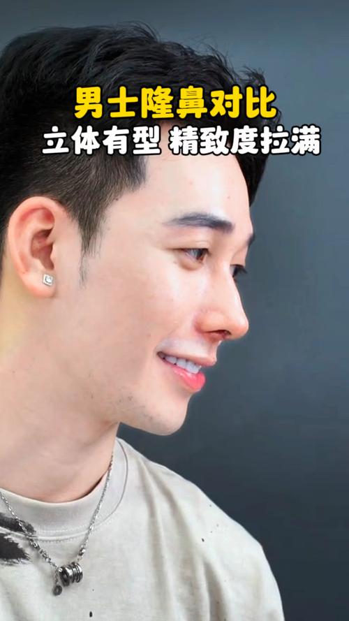 男性钻石鼻美学发布：探究适合中国男性美鼻思路和解决方案