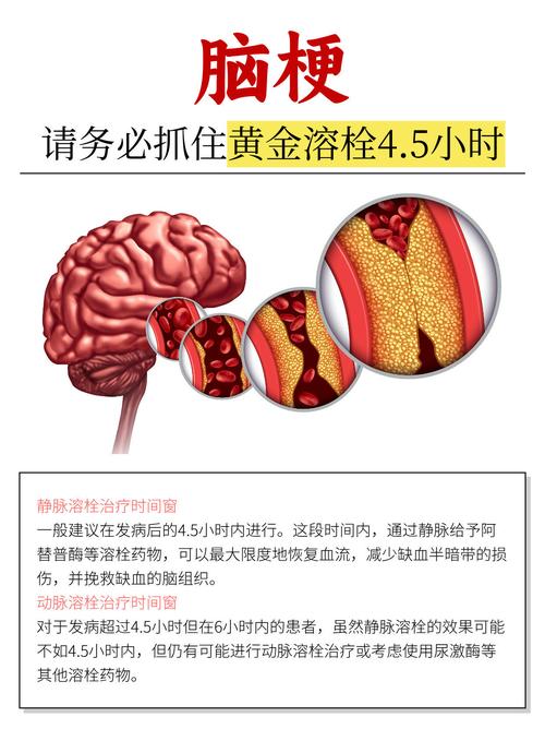 勃林格殷格翰新一代溶栓药物美通立在华获批 用于治疗急性缺血性卒中
