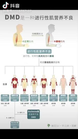 Novotech 发布杜氏肌营养不良症前景报告支持生物技术研究计划