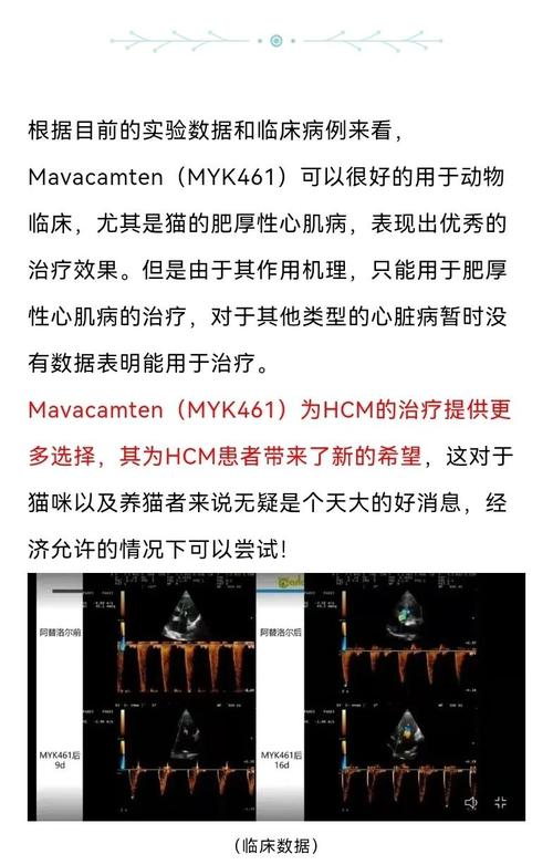 联拓生物公布肥厚型心肌病新药临床III期试验完整数据
