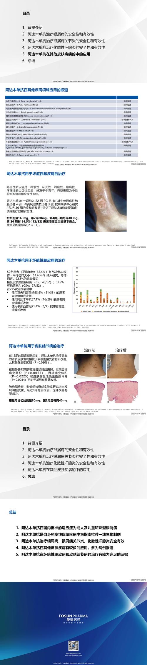 Zenas BioPharma 宣布在《柳叶刀风湿病学》上发表研究性药物 Obexelimab 相关疾病研究报告