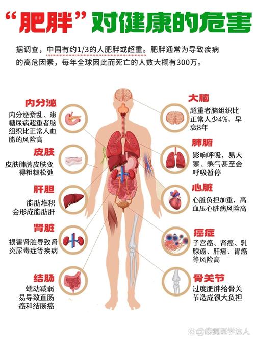 肥胖人群往往低估体重对健康的影响 约90%至少有1种并发症