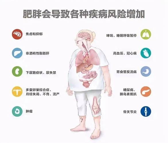 肥胖人群往往低估体重对健康的影响 约90%至少有1种并发症