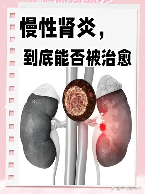 慢性肾脏病知晓率仅有12.5% 专家：肾性贫血危害不容小觑