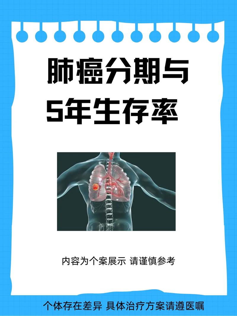 2025年将肺癌五年存活率提高一倍的目标