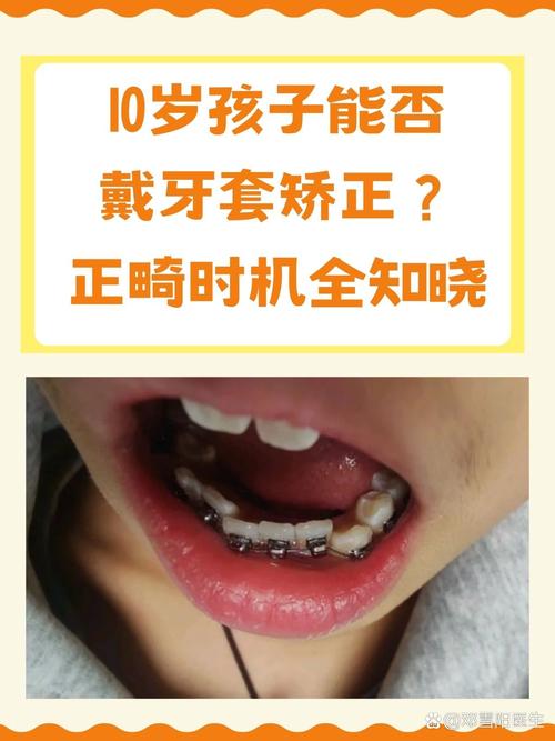 儿童牙齿过早矫正乱象调查：两岁半幼童竟被要求每天戴12小时牙套